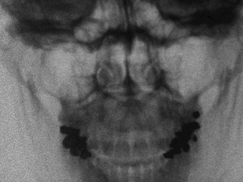 Barbara Hammer, I Was/I Am (1973)